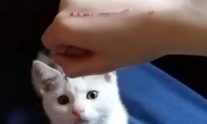 被猫抓伤需要打针吗?