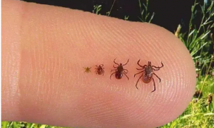 人身上发现很小的蜱虫怎么办