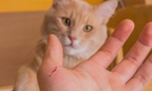 被猫抓一下高烧14天，流浪猫有多危险？