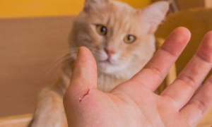 被家猫咬了轻微出血有事吗