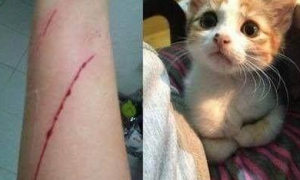 为什么猫咪容易抓伤呢