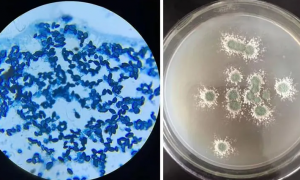 哈茨木霉菌繁殖方法