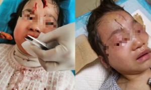 江苏宿迁，公职人员养狗不栓绳，5岁女孩被狗咬伤毁容